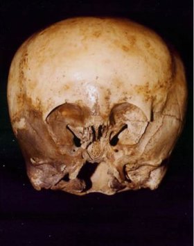 starchild-skull-small.jpg?w=280&h=354